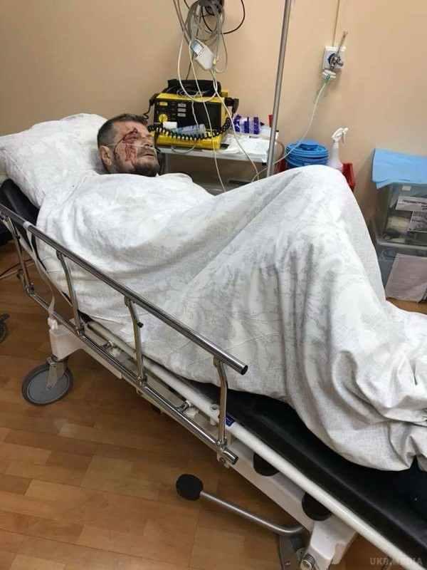 Поранений під час вибуху нардеп з Полтавщини Ігор Мосійчук назвав підозрюваних у замаху на нього