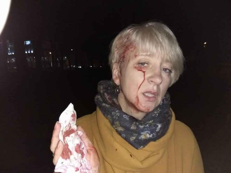 Побиття полтавської судді Лариси Гольник та її чоловіка: що каже прокуратура. ВІДЕО