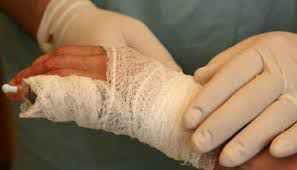 На Полтавщині немовля ошпарилося окропом