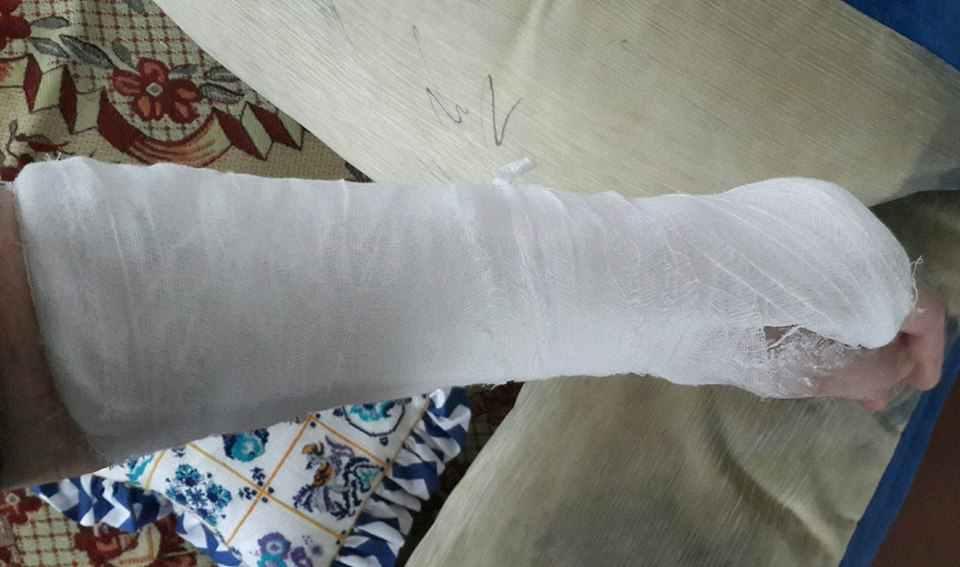 Полтавці падають і калічаться у підземних переходах, де покинутий ремонт. ФОТО