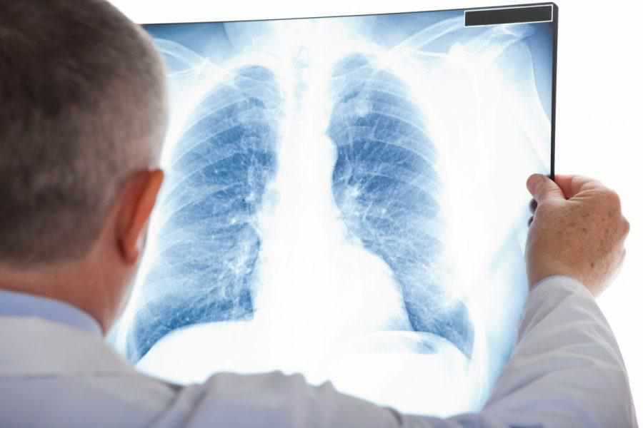 Відоме та нове про туберкульоз: чого остерігатись, коли йти до лікаря та як позбутись недуги. ФОТО, ВІДЕО